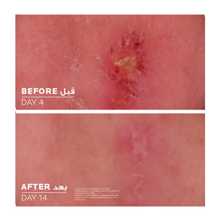 Cicaplast Baume B5 Moisturizing Cream For Dry Skin