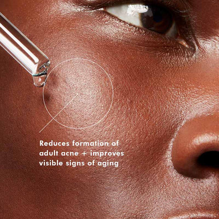 Blemish + Age Defense