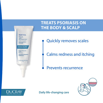 Kertyol P.S.O. Cream 100ML