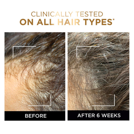 L’Oréal Paris Elvive Fall Resist Anti Hair-Fall Serum with Aminexil